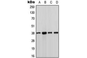 Western blot analysis of CK1 alpha expression in MCF7 (A), Jurkat (B), NIH3T3 (C), H9C2 (D) whole cell lysates. (CSNK1A1 Antikörper  (Center))