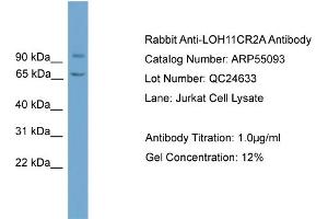 WB Suggested Anti-LOH11CR2A  Antibody Titration: 0. (VWA5A Antikörper  (N-Term))