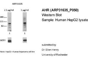 Western Blotting (WB) image for anti-Aryl Hydrocarbon Receptor (AHR) (N-Term) antibody (ABIN2777386) (Aryl Hydrocarbon Receptor Antikörper  (N-Term))