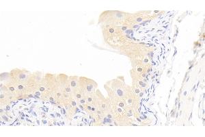 Detection of MMP13 in Rabbit Bladder Tissue using Polyclonal Antibody to Matrix Metalloproteinase 13 (MMP13) (MMP13 Antikörper  (AA 70-245))