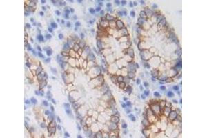 Immunohistochemistry (IHC) image for anti-UDP-Gal:betaGlcNAc beta 1,3-Galactosyltransferase, Polypeptide 5 (B3GALT5) (AA 29-310) antibody (ABIN7443638)