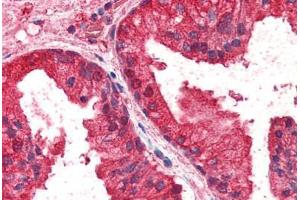 Human Prostate (formalin-fixed, paraffin-embedded) stained with CREB3L4 antibody ABIN337002 at 2. (CREB3L4 Antikörper  (AA 382-395))