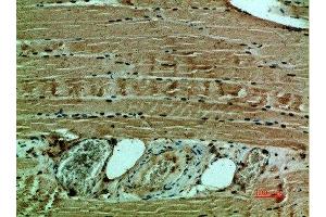 Immunohistochemical analysis of paraffin-embedded human-muscle, antibody was diluted at 1:200 (COL12A1 Antikörper  (AA 1268-1341))