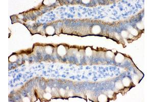 Anti- Villin Picoband antibody,IHC(P) IHC(P): Rat Intestine Tissue