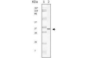 Western blot analysis using SARS-mpm mouse mAb against SARS-mpm recombinant protein.