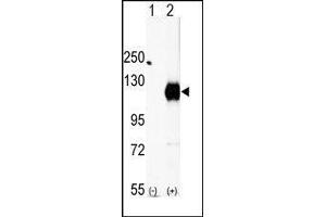 Western blot analysis of EphA2 (arrow) using rabbit polyclonal EphA2 Antibody (EPH Receptor A2 Antikörper  (C-Term))