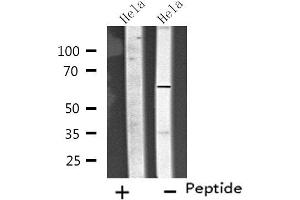Western blot analysis of extracts from Hela cells, using CP26C antibody. (CYP26C1 Antikörper  (Internal Region))