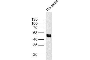 Mouse placenta lysates probed with Akt1/3 Polyclonal Antibody, unconjugated  at 1:300 overnight at 4°C followed by a conjugated secondary antibody at 1:10000 for 90 minutes at 37°C. (AKT1/3 (AA 401-479) Antikörper)