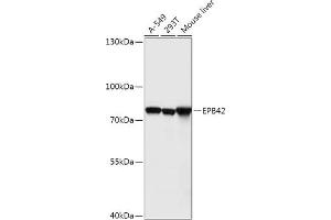 Western blot analysis of extracts of various cell lines, using EPB42 antibody (ABIN7267007) at 1:1000 dilution. (EPB42 Antikörper  (AA 10-240))