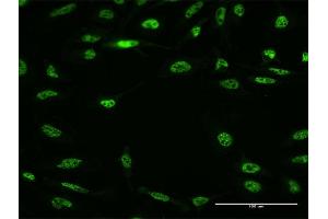Immunofluorescence of monoclonal antibody to RBM5 on HeLa cell. (RBM5 Antikörper  (AA 75-184))