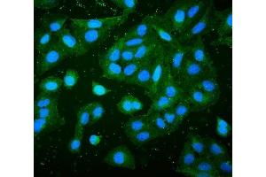 IF analysis of RP2 using anti-RP2 antibody (ABIN7600869).