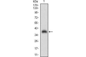 Western blot analysis using CGA mAb against human CGA (AA: 25-147) recombinant protein. (CGA Antikörper  (AA 25-147))