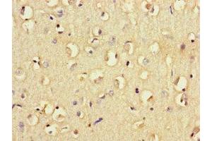 Immunohistochemistry (IHC) image for anti-Fc Fragment of IgG, Low Affinity IIb, Receptor (CD32) (FCGR2B) (AA 12-289) antibody (ABIN7158541)