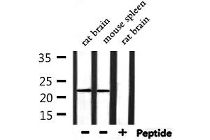 Western blot analysis of extracts from rat brain and mouse spleen, using RPL14 Antibody. (RPL14 Antikörper  (Internal Region))