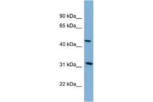 WB Suggested Anti-SERPINI2 Antibody Titration: 0. (SERPINI2 Antikörper  (Middle Region))