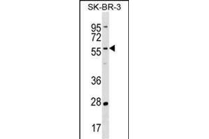Western Blotting (WB) image for anti-TAF6-Like RNA Polymerase II, P300/CBP-Associated Factor (PCAF)-Associated Factor, 65kDa (TAF6L) (AA 77-103), (N-Term) antibody (ABIN1539596)
