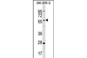 TAF6L Antibody (N-term) (ABIN1539596 and ABIN2838215) western blot analysis in SK-BR-3 cell line lysates (35 μg/lane).