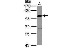 WB Image Sample (30 ug of whole cell lysate) A: HeLa 7. (UHRF1 Antikörper)