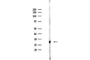 Western blot analysis of lysates from Mouse liver, using ABHA Antibody at 1/1000 dilution.