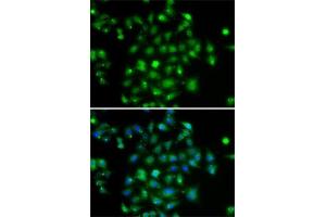 Immunofluorescence analysis of A-549 cells using DYRK2 antibody (ABIN6130879, ABIN6139897, ABIN6139898 and ABIN6222785). (DYRK2 Antikörper  (AA 429-528))