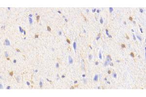 Detection of GS in Human Cerebellum Tissue using Polyclonal Antibody to Glutamine synthetase (GS) (GLN1 Antikörper  (AA 1-373))
