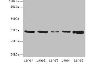 Western blot All lanes: UCP3 antibody at 0. (UCP3 Antikörper  (AA 33-76))