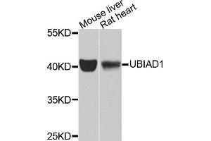 Western blot analysis of extracts of mouse liver and rat heart tissues, using UBIAD1 antibody. (UBIAD1 Antikörper)