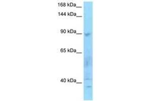 Image no. 1 for anti-SECIS Binding Protein 2 (SECISBP2) (AA 159-208) antibody (ABIN6748255)