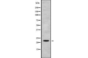 Western blot analysis of Histone H1X using K562 whole cell lysates
