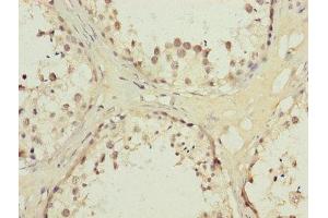 Immunohistochemistry of paraffin-embedded human testis tissue using ABIN7142330 at dilution of 1:100 (AKR1D1 Antikörper  (AA 1-200))