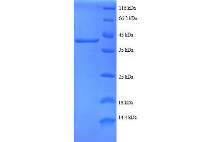 Ribosomal Protein S24 (RPS24) (AA 2-133), (partial) protein (GST tag) (RPS24 Protein (AA 2-133, partial) (GST tag))