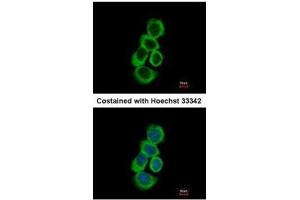 ICC/IF Image Immunofluorescence analysis of methanol-fixed A431, using BHMT, antibody at 1:500 dilution. (BHMT Antikörper)