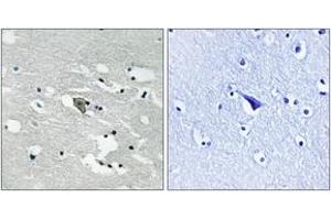 Immunohistochemistry analysis of paraffin-embedded human brain, using VEGFR1 (Phospho-Tyr1048) Antibody. (FLT1 Antikörper  (pTyr1048))