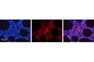 Rabbit Anti-STAT5A Antibody   Formalin Fixed Paraffin Embedded Tissue: Human Bone Marrow Tissue Observed Staining: Cytoplasm, Nucleus Primary Antibody Concentration: 1:100 Other Working Concentrations: N/A Secondary Antibody: Donkey anti-Rabbit-Cy3 Secondary Antibody Concentration: 1:200 Magnification: 20X Exposure Time: 0.