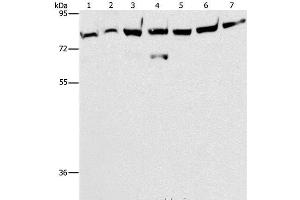 Western Blot analysis of A172 cell and Mouse brain tissue, K562, 231, A549, hela and hepG2 cell using PKC epsilon Polyclonal Antibody at dilution of 1:400 (PKC epsilon Antikörper)