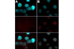 Histone H2AX phospho Ser139 antibody tested by immunofluorescence. (H2AFX Antikörper  (pSer139))