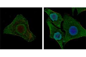 Confocal immunofluorescence analysis of MCF-7 (left) and HepG2 (right) cells using BRAF mouse mAb (green). (BRAF Antikörper)