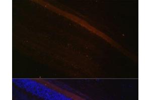 Immunofluorescence analysis of Rat retina using GRK1 Polyclonal Antibody at dilution of 1:100 (40x lens). (GRK1 Antikörper)