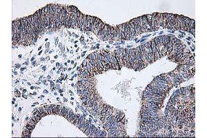 Immunohistochemistry (IHC) image for anti-Dihydrolipoamide Dehydrogenase (DLD) antibody (ABIN1497846) (DLD Antikörper)