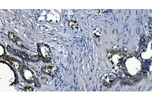 IHC analysis of PCBP2/hnRNP E2 using anti-PCBP2/hnRNP E2 antibody (ABIN7600449). (PCBP2 Antikörper  (AA 197-276))