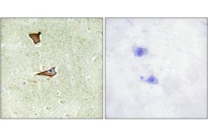 Immunohistochemical analysis of paraffin-embedded human brain tissue using IGF2R (Phospho-Ser2409) antibody (left)or the same antibody preincubated with blocking peptide (right). (IGF2R Antikörper  (pSer2409))