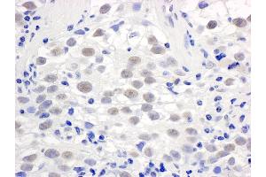 Immunohistochemistry (IHC) image for anti-Proline-, Glutamic Acid- and Leucine-Rich Protein 1 (PELP1) (AA 25-75) antibody (ABIN7454378)
