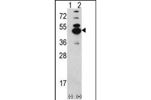 Western blot analysis of CK1D (arrow) using rabbit polyclonal CK1D Antibody (N-term) (ABIN391308 and ABIN2841343). (CAMK1D Antikörper  (N-Term))