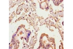 Immunohistochemistry (IHC) image for anti-Microtubule Associated Monoxygenase, Calponin and LIM Domain Containing 2 (MICAL2) (AA 1-495) antibody (ABIN7141994)