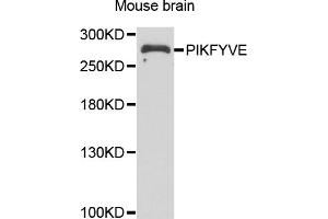 Western blot analysis of extracts of mouse brain, using PIKFYVE antibody (ABIN5974035) at 1/1000 dilution.