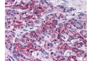 Human Pancreas: Formalin-Fixed, Paraffin-Embedded (FFPE) (XIAP Antikörper  (AA 75-226))