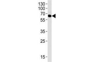 Western blot analysis of lysate from 293 cell line using FYN antibody at 1:1000. (FYN Antikörper)