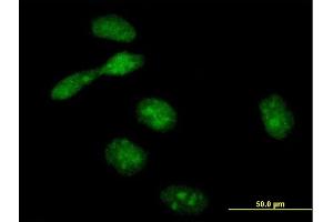 Immunofluorescence of purified MaxPab antibody to EME1 on HeLa cell.