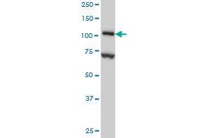 Western Blotting (WB) image for anti-Dihydropyrimidine Dehydrogenase (DPYD) (AA 1-110) antibody (ABIN560640)