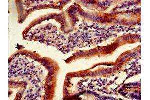 Immunohistochemistry of paraffin-embedded human duodenum tissue using ABIN7163465 at dilution of 1:100 (PITX2 Antikörper  (AA 40-154))